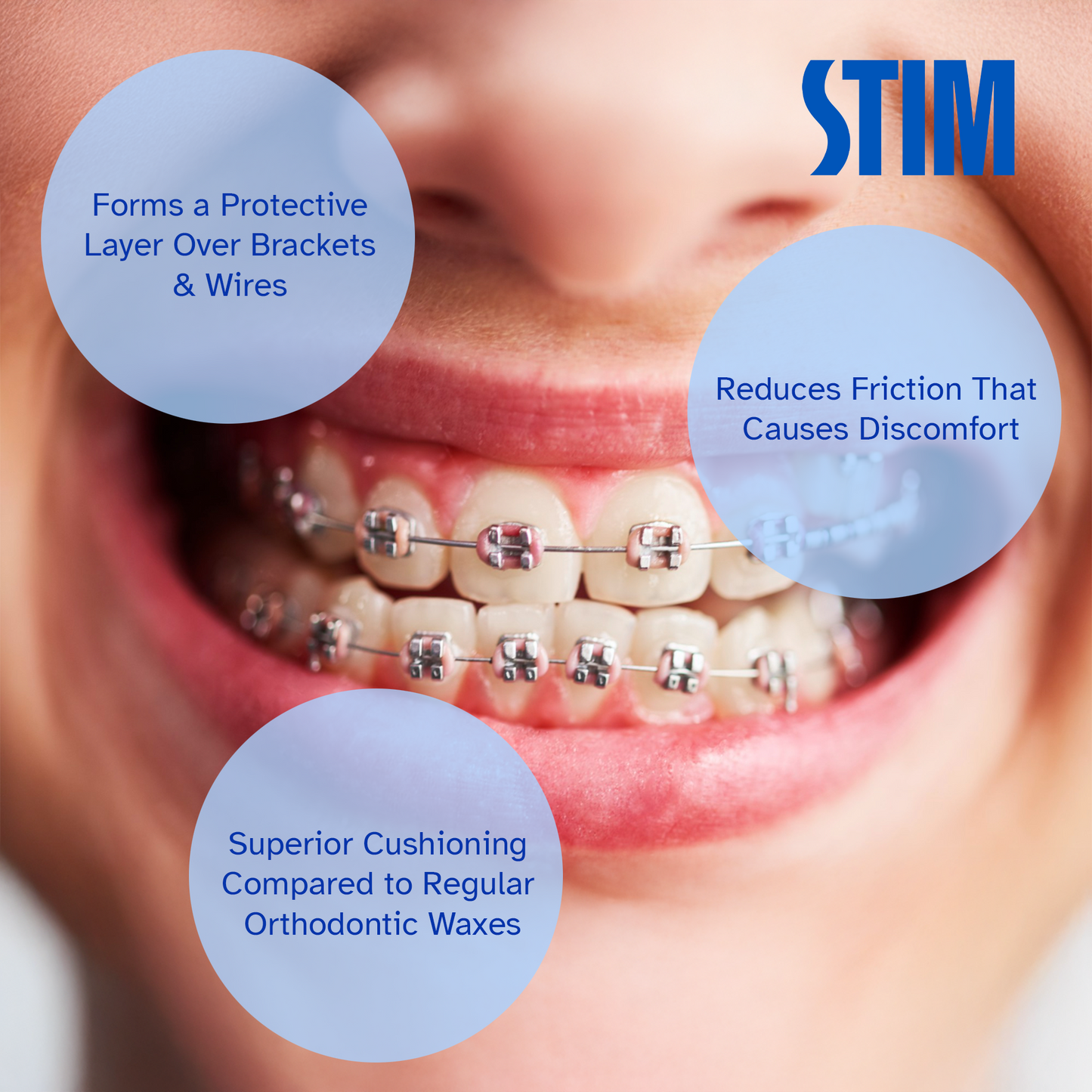 STIM - EX Wax strips for Braces (Pack of 2)